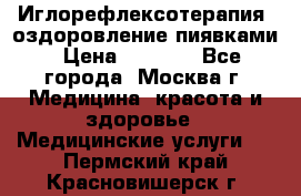 Иглорефлексотерапия, оздоровление пиявками › Цена ­ 3 000 - Все города, Москва г. Медицина, красота и здоровье » Медицинские услуги   . Пермский край,Красновишерск г.